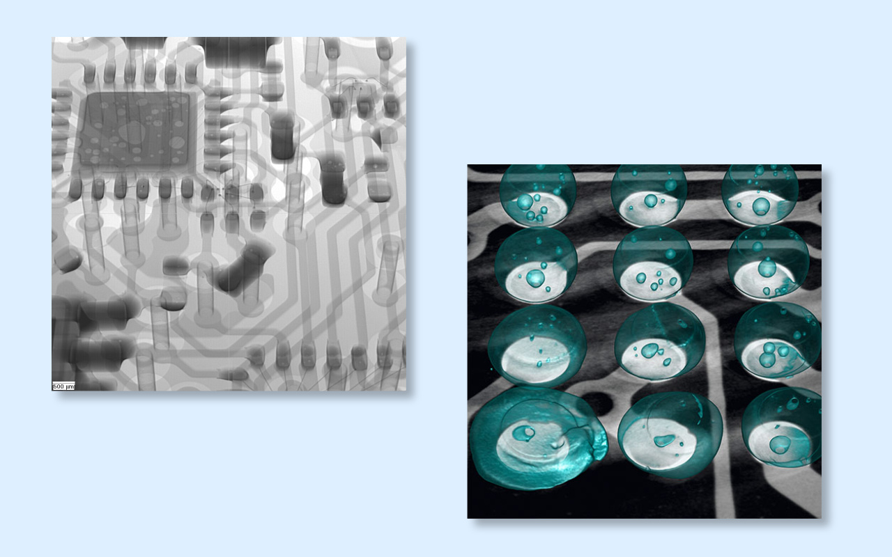 4. 2D vs 3D CT X-ray Which One Do You Really Need? 4. Chụp X-quang 2D và 3D CT Bạn thực sự cần cái nào?