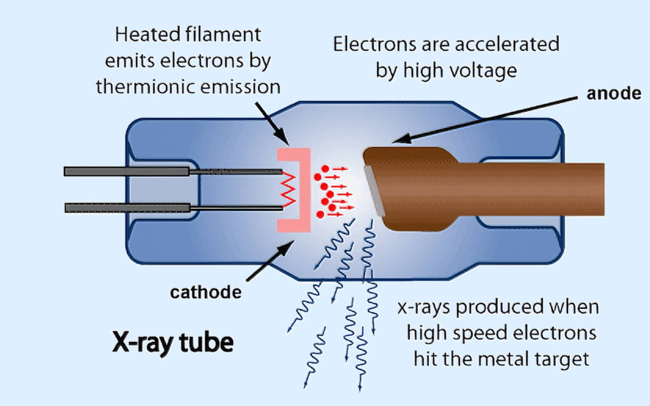 2. What X-ray Technology Actually Does 2. Công nghệ X-quang thực sự có tác dụng gì